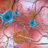 Start of new era for Alzheimer’s treatment